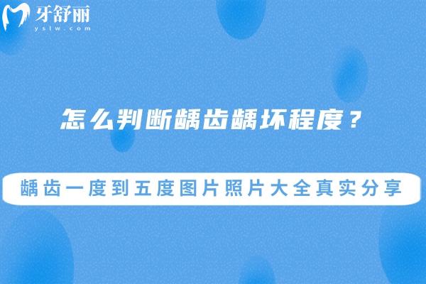 怎么判断龋齿龋坏程度?龋齿一度到五度图片照片大全真实分享