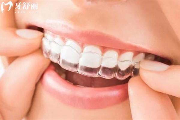 永州看牙多少钱