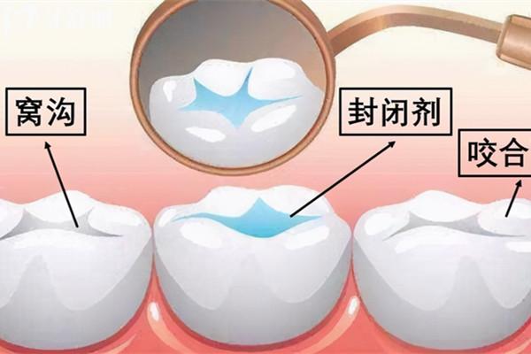 永州看牙多少钱