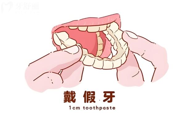 年轻人用什么假牙比较好?年轻人装假牙能吃硬东西吗?这份指南让你吃得香笑得更自信
