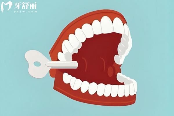 年轻人用什么假牙比较好?年轻人装假牙能吃硬东西吗?这份指南让你吃得香笑得更自信
