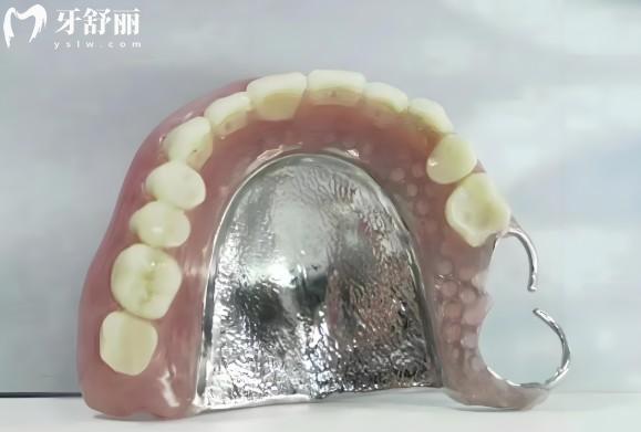 长沙装吸附性义齿全口假牙需要多少钱
