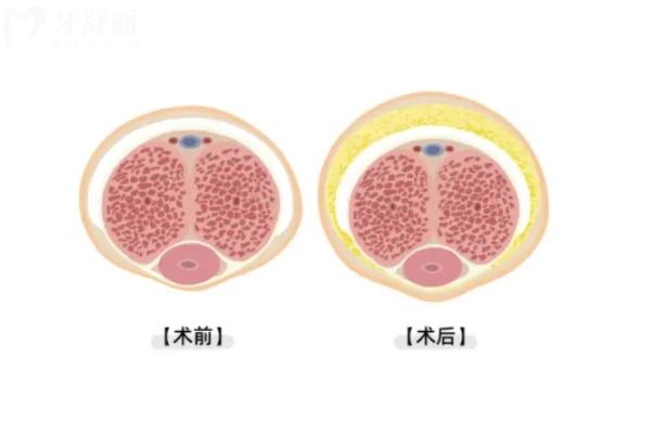 邱鸿飞医生做男科怎么样？