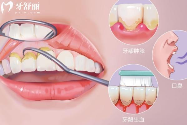 临汾合美口腔补牙是正规的吗？