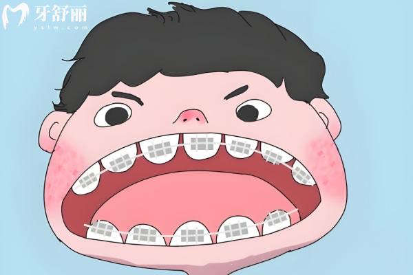 选对牙科不踩坑！上海宝山区牙科医院哪个好？10家靠谱机构真实盘点