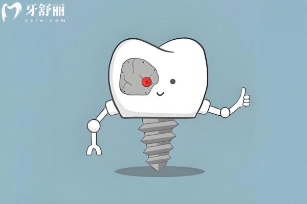 重庆口碑好的种植牙医院名单：种牙不再愁，好牙吃遍山城