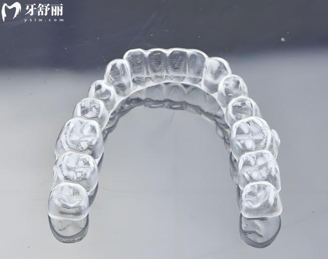 成都牙齿矫正价格表2025公开:暑期学生矫正优惠力度大,收费透明口碑佳