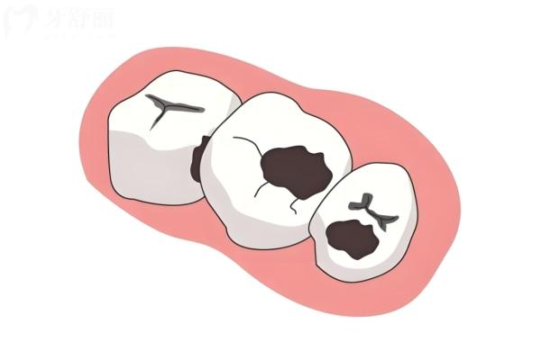 别再被骗！莆田系口腔医院能去吗?揭秘国内正规口腔医院哪家好一点放心去
