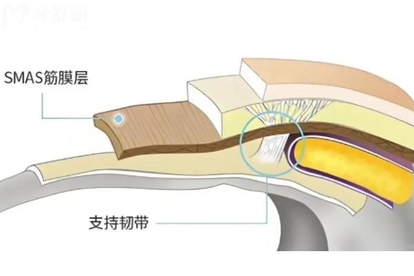 李建钢筋膜提升真的有用吗