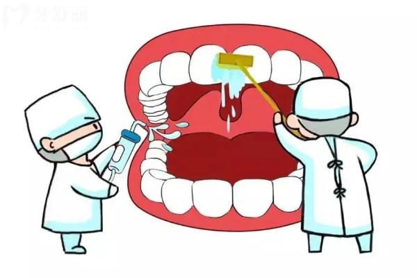 牙周炎会传染吗？不一定，分享牙周炎的预防与治疗