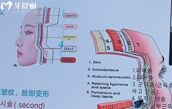 成都面部抗衰李建钢筋膜提升做的好:通过技术优势/顾客实例/口碑分享便知