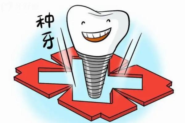 石家庄种植牙2025收费价目表:种牙价格医院名单全透明看这篇就够了！