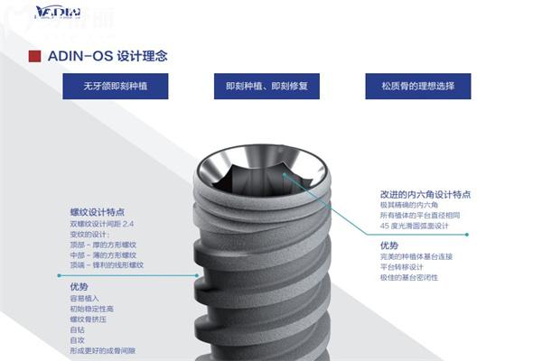 以色列雅定种植牙是什么档次?韩国的植体比哪种好?多少钱一颗?