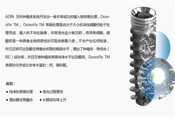 以色列雅定种植牙是什么档次?韩国的植体比哪种好?多少钱一颗?