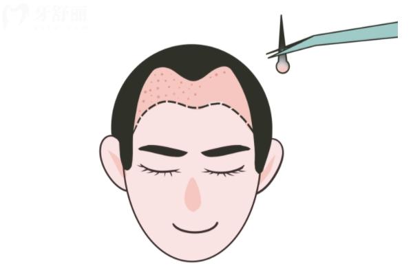 东莞科生植发医院怎么样