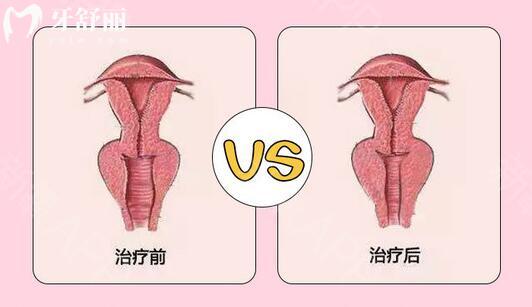 武汉私密整形价格表