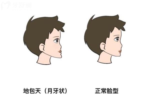 地包天