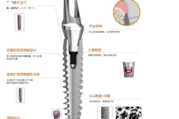 延安种植牙多少钱一颗？