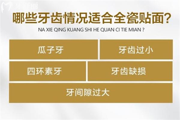 全瓷牙贴面大概多少钱?单颗