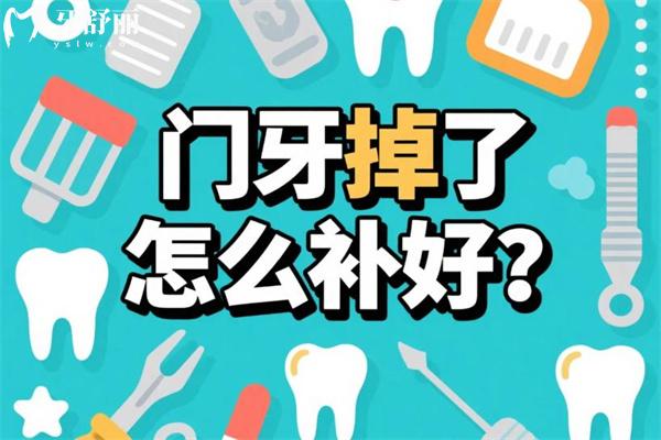 门牙掉了怎么补好?门牙缺失好的修复方法有哪些?门牙掉了怎么办看过便知!