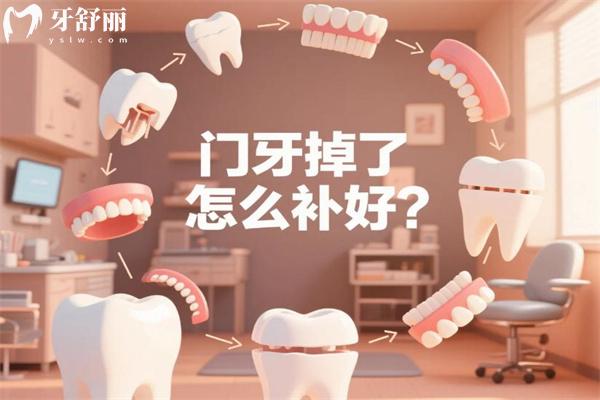 门牙掉了怎么补好?门牙缺失好的修复方法有哪些?门牙掉了怎么办看过便知!