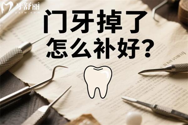 门牙掉了怎么补好?门牙缺失好的修复方法有哪些?门牙掉了怎么办看过便知!