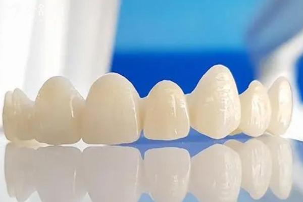 威兰德臻瓷和普通全瓷牙区别
