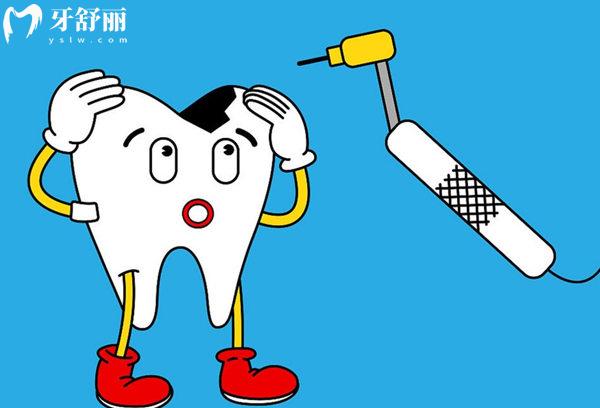 坏牙图片大全及类型图查看:揭秘不同坏牙的发展过程及治疗方案