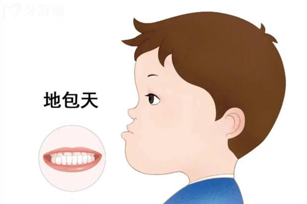 地包天换牙后能自己变正常吗