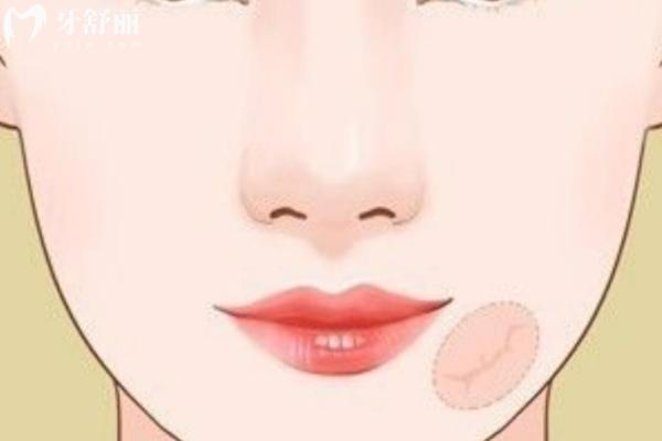 武汉同济医学院医院医疗美容怎么样？