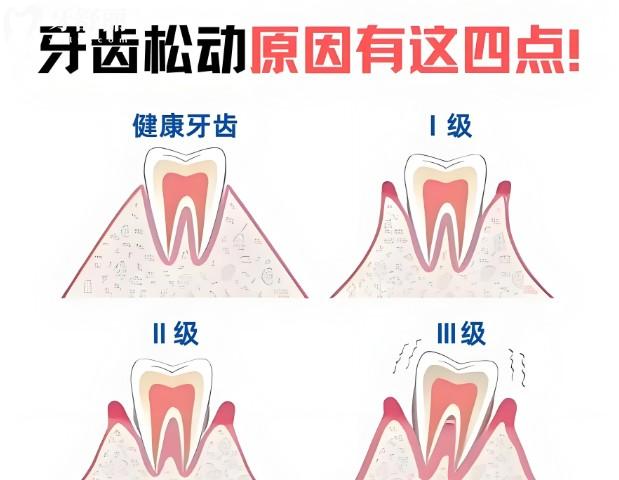 贺州牙科医院镶牙价格表