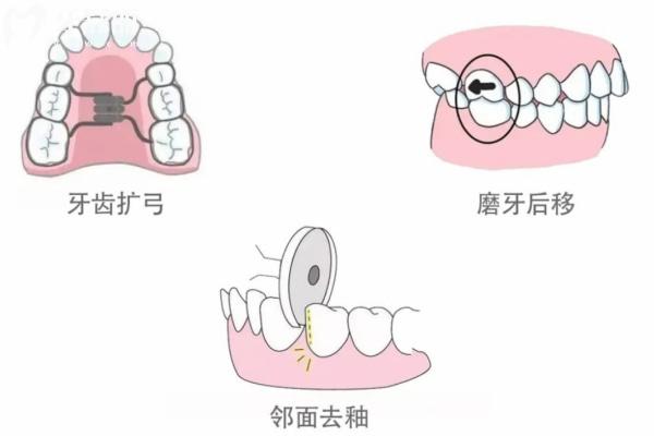 2025哈密**排名前十:细数五家牙科的技术绝活种牙矫牙这样选就对了！
