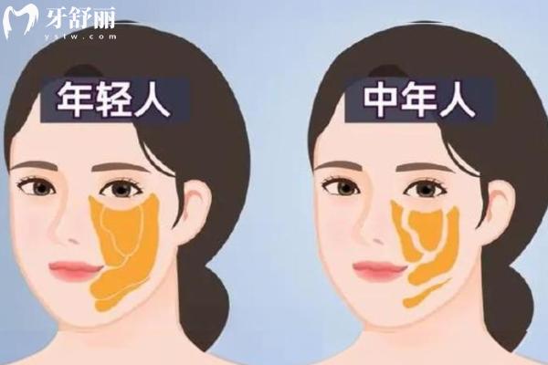 v拉美和超声炮哪个好