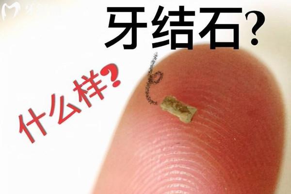 杭州口腔医院收费标准