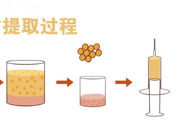 成都华生铂悦威塑吸脂怎么样？