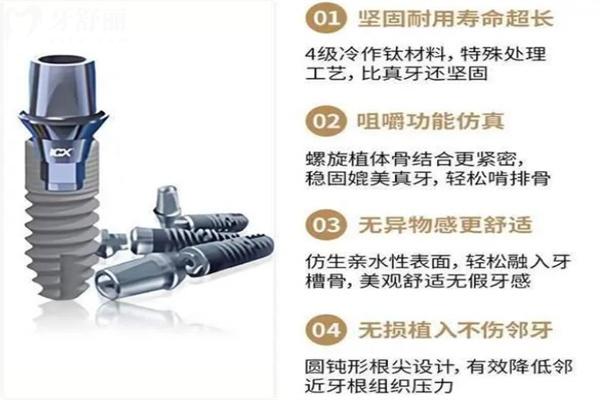 种植牙不同品牌能维持几年寿命?韩系/欧美等中高低端植体10-40年不等