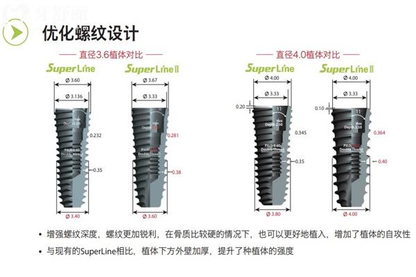 种植牙不同品牌能维持几年寿命?韩系/欧美等中高低端植体10-40年不等