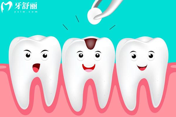 广州口腔医院看牙多少钱