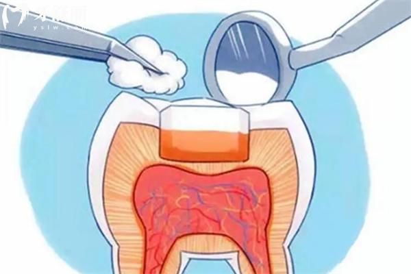 巴彦淖尔口腔医院价格表:2025版收费标准种牙矫正等牙科治疗费用更加划算