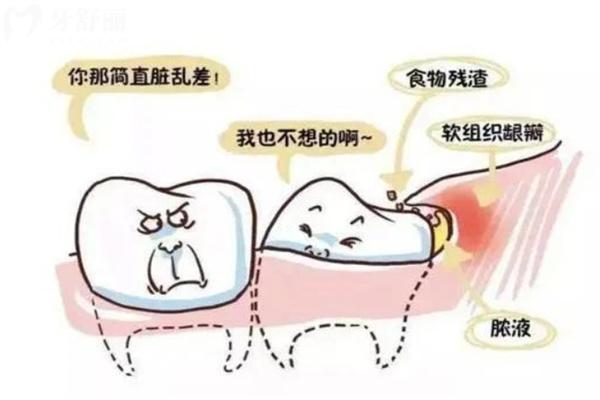 温州牙科医院收费标准:种植牙2500+牙齿矫正7800+镶牙修复详细价格一览