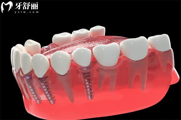 衢州看牙齿哪里好还便宜?查询2025超全的衢州牙科收费价格表+衢州十大口腔医院排名榜