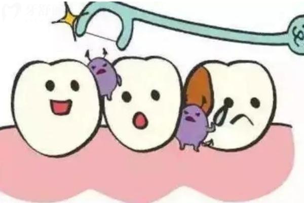 广州牙科医院2025年收费标准:看牙价目医院名单全公开,教你省钱又放心！