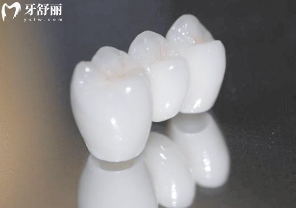 国产爱尔创和日本则武哪个好?从质量/美观度/使用寿命/价格对比区别