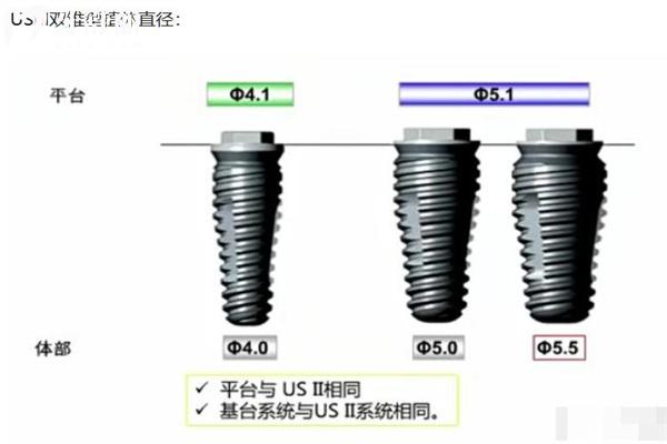 奥齿泰种植体型号和规格表大全:四大系列满足不同患者种植需求