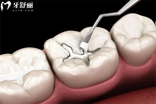 杭州看牙需要多少钱?全新的杭州牙科收费价目表含种植牙