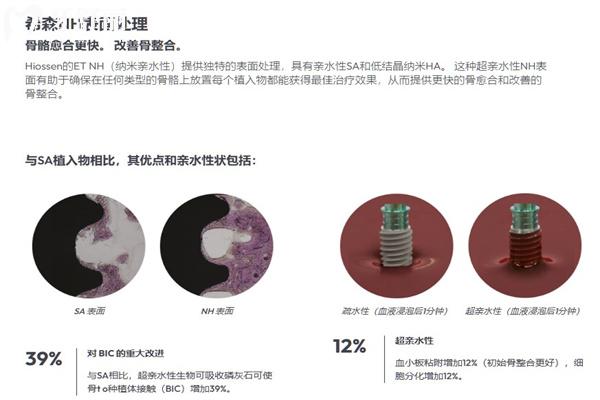 进口种植牙哪个品牌好?国内常用十大进口种植牙品牌排名榜