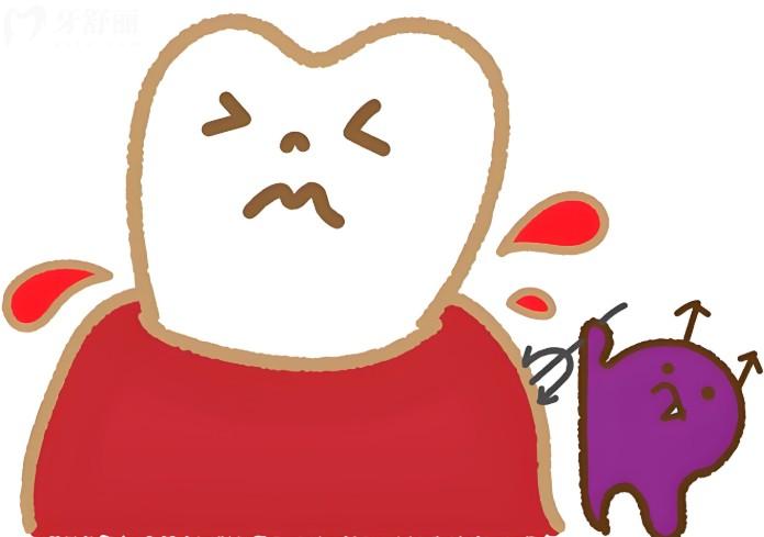 慢性牙髓炎是什么怎么处理