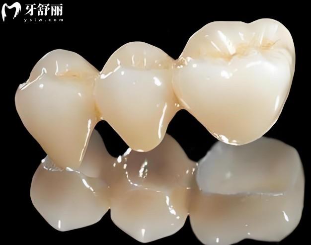 德国臻瓷是什么档次的品牌