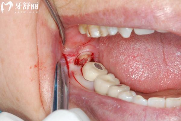 常州牙科医院收费价目表