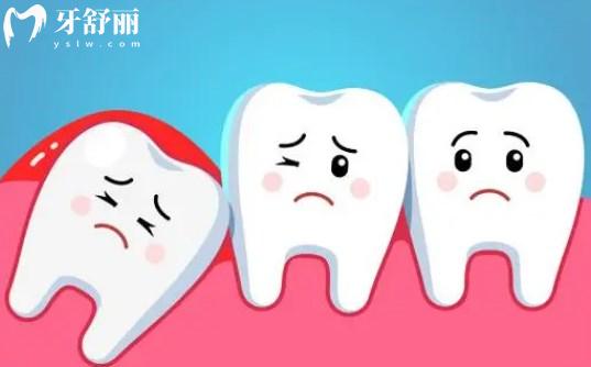 雅安牙科医院拔牙多少钱一颗